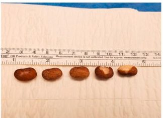 ‘Second-hand’ psychological stress can lead to depression in mice, says study 'Second-hand' psychological stress can lead to depression in mice, says study