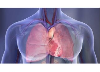 Study: Outcomes after heart bypass surgery better with ‘no-touch’ technique to remove leg veins Study: Outcomes after heart bypass surgery better with ‘no-touch’ technique to remove leg veins