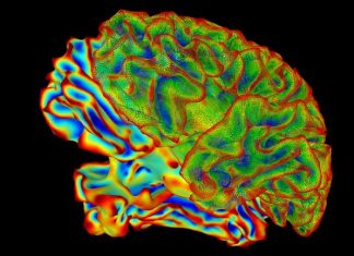 Researchers identify the cause of Alzheimer’s progression in the brain Researchers identify the cause of Alzheimer’s progression in the brain