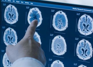 Researchers report first electrically invoked perseverance response Researchers report first electrically invoked perseverance response