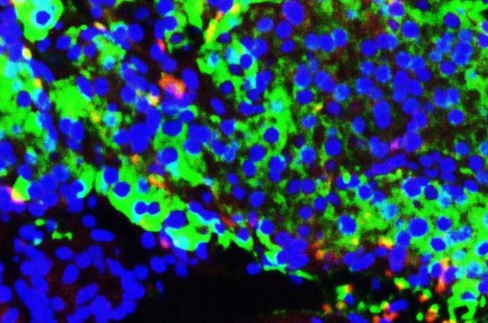 Salk researchers create functional human beta cells in the lab