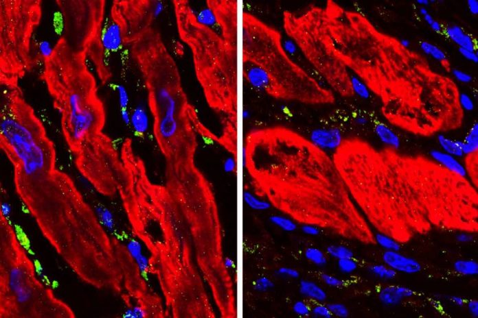 Scientists discover an unexpected regulator of heart repair