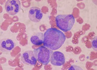 Study: Bone marrow backup needed to tackle respiratory infections Study: Bone marrow backup needed to tackle respiratory infections