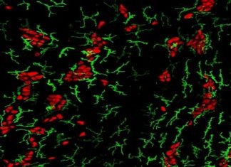 Study: How foodborne diseases protect the gut’s nervous system Study: How foodborne diseases protect the gut's nervous system