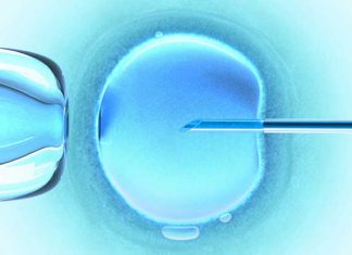 Assisted conception leads to adverse outcomes Assisted conception leads to adverse outcomes