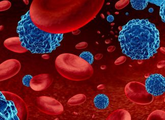 Research confirms nutrient’s role in childhood blood cancer Research confirms nutrient’s role in childhood blood cancer