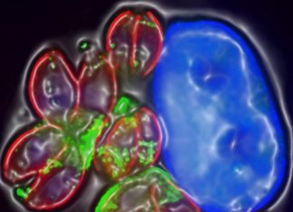 Study: Toxoplasma parasites manipulate brain cells to survive Study: Toxoplasma parasites manipulate brain cells to survive