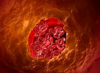 High cholesterol increases breast cancer risk by 164 percent High cholesterol increases breast cancer risk by 164 percent