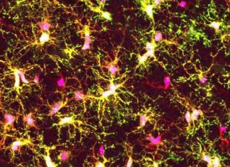 Research targets the methylation profile of microglia from human brain Research targets the methylation profile of microglia from human brain