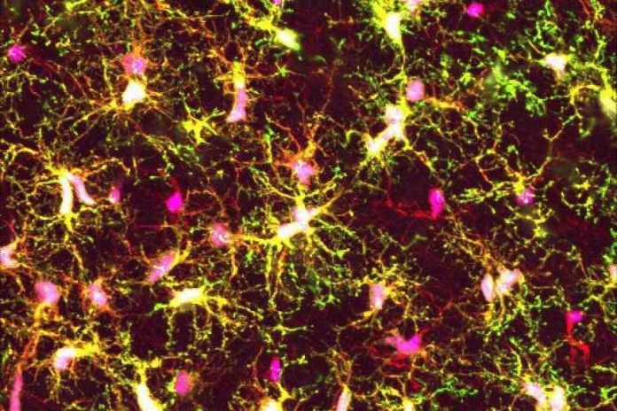 Research targets the methylation profile of microglia from human brain