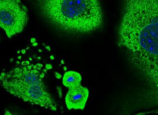 Scientists reveal how skin cells form a first line of defense against cancer Scientists reveal how skin cells form a first line of defense against cancer
