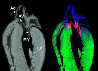 Study: Imaging collagen – a new technique for therapeutics? Study: Imaging collagen – a new technique for therapeutics?