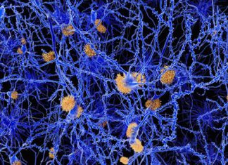 Study shows no Alzheimer’s drug in near future Study shows no Alzheimer’s drug in near future