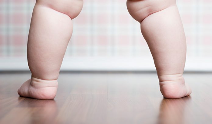 C-section and antibiotics during pregnancy increase childhood obesity risk