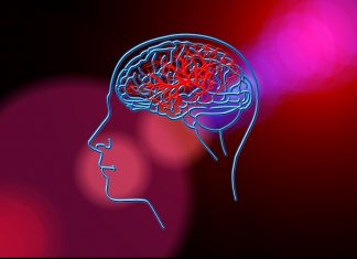 Five elements to optimize treatment of in-hospital stroke Five elements to optimize treatment of in-hospital stroke