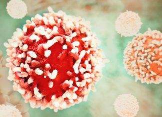 Research presents novel treatment strategy to tackle metastatic intra-abdominal cancer Research presents novel treatment strategy to tackle metastatic intra-abdominal cancer