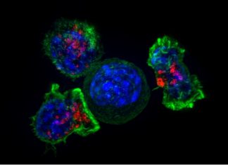 Scientists develop model to predict treatment response in gastric cancer Scientists develop model to predict treatment response in gastric cancer