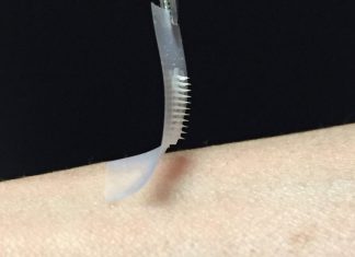 Smart insulin patch could provide painless blood glucose control for diabetics Smart insulin patch could provide painless blood glucose control for diabetics