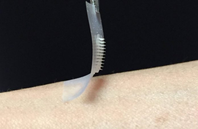 Smart insulin patch could provide painless blood glucose control for diabetics