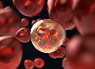 Study: Risks after treatment for cervical neoplasia have declined over time Study: Risks after treatment for cervical neoplasia have declined over time