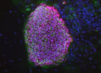 Treating diabetes via embryonic cloning holds promise Treating diabetes via embryonic cloning holds promise