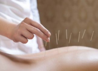 Acupuncture may help to reduce hot flashes Acupuncture may help to reduce hot flashes