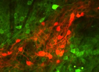 Research finds neurons that encode the outcomes of actions Research finds neurons that encode the outcomes of actions