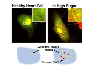 Researchers to use innovative imaging technique in NIH-funded research on diabetic heart failure treatments Researchers to use innovative imaging technique in NIH-funded research on diabetic heart failure treatments