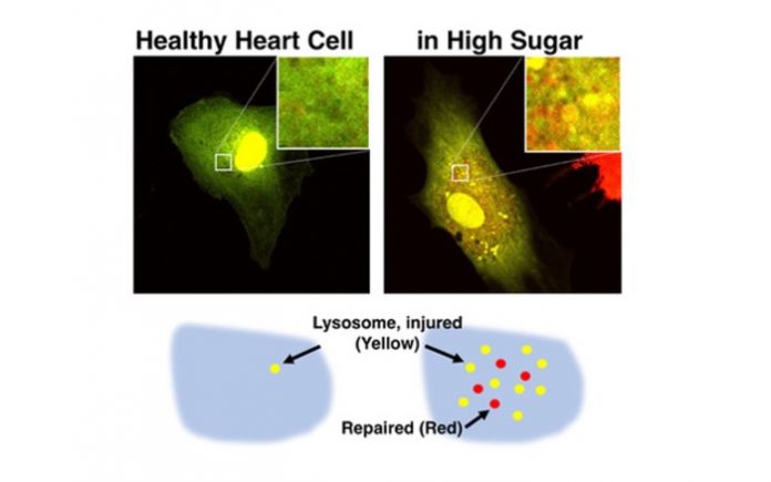 Researchers to use innovative imaging technique in NIH-funded research on diabetic heart failure treatments