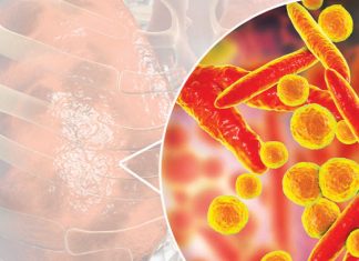 Risk for pneumonia may be increased by sedatives Risk for pneumonia may be increased by sedatives