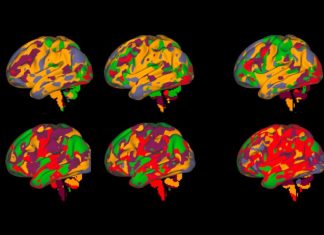 Scientists find that blood pressure medications impact brain function Scientists find that blood pressure medications impact brain function