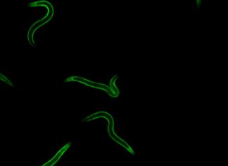 Researchers identify genetic variants linked to mobility changes in aging Researchers identify genetic variants linked to mobility changes in aging