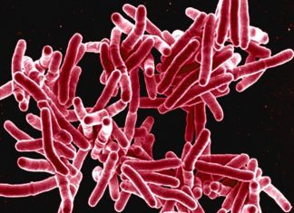 Study: Body’s Response to Different Strains of Tuberculosis Could Affect Transmission Study: Body’s Response to Different Strains of Tuberculosis Could Affect Transmission