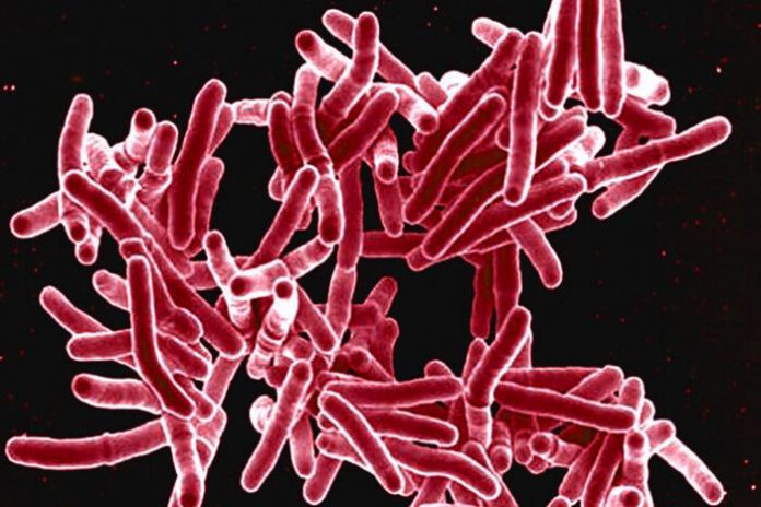 Study: Body’s Response to Different Strains of Tuberculosis Could Affect Transmission