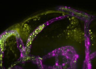 Study: Fungal meningitis spreads by blocking and bursting blood vessels Study: Fungal meningitis spreads by blocking and bursting blood vessels