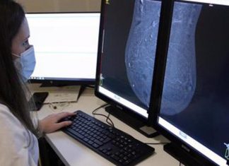 Study finds age group that benefits most from a mammogram Study finds age group that benefits most from a mammogram