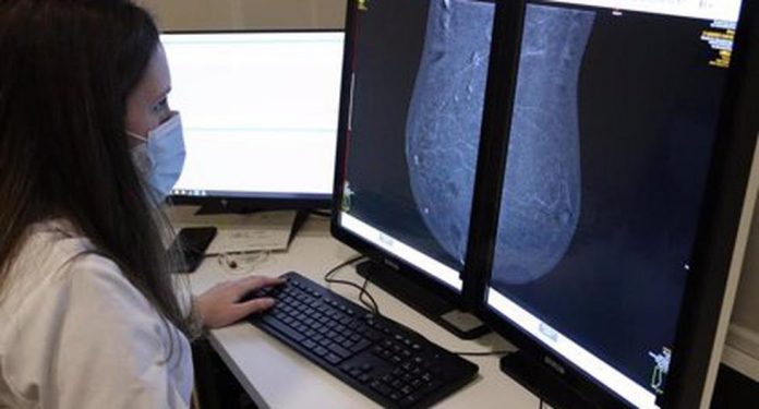 Study finds age group that benefits most from a mammogram
