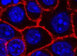 New study pushes closer to new therapy for pancreatic cancer New study pushes closer to new therapy for pancreatic cancer