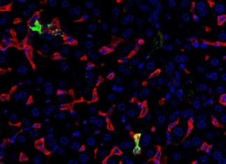 New study sheds light on crimean-congo hemorrhagic fever disease process New study sheds light on crimean-congo hemorrhagic fever disease process