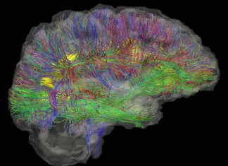 Research offers deeper insight into the complexity of the human brain Research offers deeper insight into the complexity of the human brain