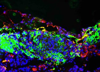 New research describes new way of generating insulin-producing cells New research describes new way of generating insulin-producing cells