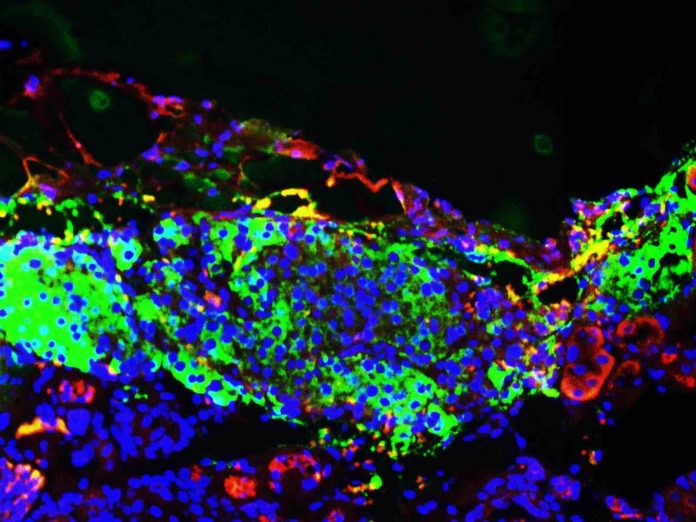 New research describes new way of generating insulin-producing cells