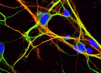 University of Bath researchers unravel the mystery of genes that are key to brain development University of Bath researchers unravel the mystery of genes that are key to brain development