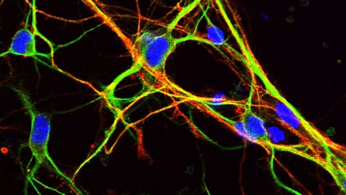 University of Bath researchers unravel the mystery of genes that are key to brain development