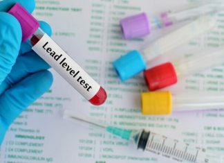 Blood lead concentrations linked to behavioral problems in children Blood lead concentrations linked to behavioral problems in children