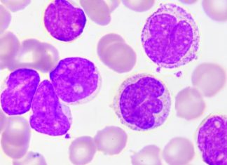 Scientists look to create artificial bone marrow treatment for leukemia Scientists look to create artificial bone marrow treatment for leukemia