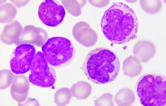 Scientists look to create artificial bone marrow treatment for leukemia