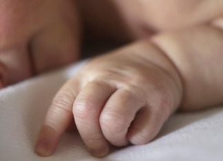 Strong link between caesarean babies and BMI Strong link between caesarean babies and BMI