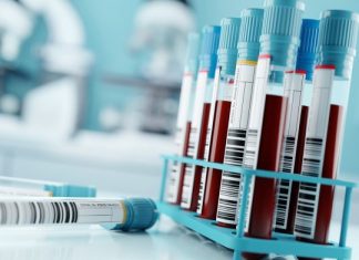 Study supports risk-based prostate cancer screening Study supports risk-based prostate cancer screening