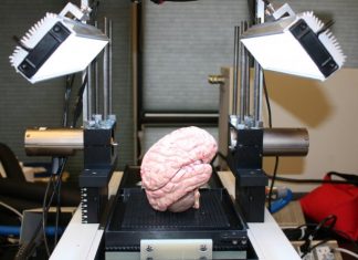 A circuit board modeled on the human brain has been created A circuit board modeled on the human brain has been created